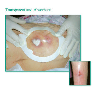 Tegaderm Clear Absorbent Acrylic Dressing 5-3/5" x 6-1/4" Oval
