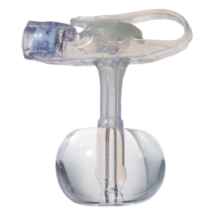 MiniONE Balloon Button Kit with ENFit, 16 Fr x 1.7 cm