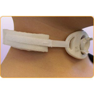 2-Piece Adult Bariatric Tracheostomy Tube Holder, 2" x 30", EA/1