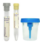 BD Vacutainer Urine Collection Kit with Screw-Cap Cup