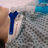 Pediatric Vent Circuit Anti-Disconnect Device, EA/1